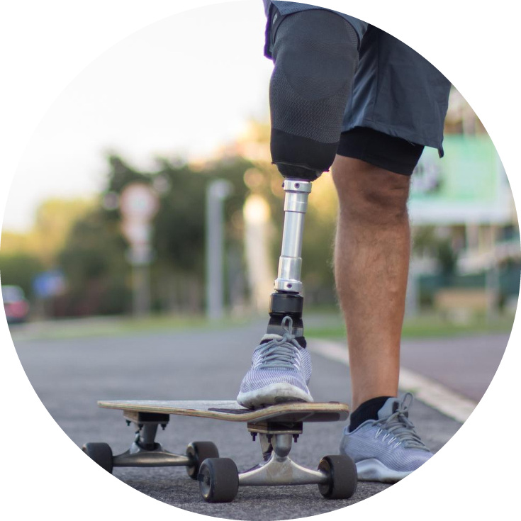user with prosthetic leg using skateboard